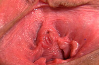 Gape My Pussy Fotos s1